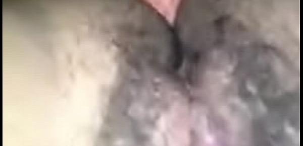  Vagina close up